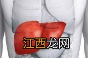 肝癌饮食注意什么 肝癌日常饮食的护理