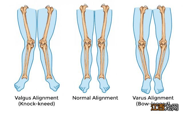 经验分享：为什么小宝宝都是O型腿？需要看医生吗？