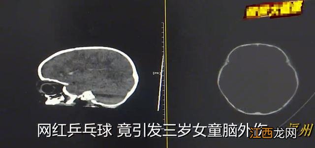 这款网红玩具宣称娃可独自玩，已致两孩子颅脑损伤，家长千万别买