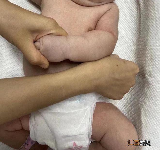 刚出生就10多斤重的“大胖小子”被紧急送医抢救 医生建议：应调节孕期饮食 严格控制血糖