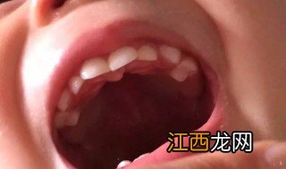 宝宝长牙的时间及顺序 宝宝怎么长牙