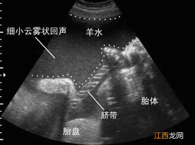 羊水名称的由来！为什么不叫胎水、人水呢？答案在这里