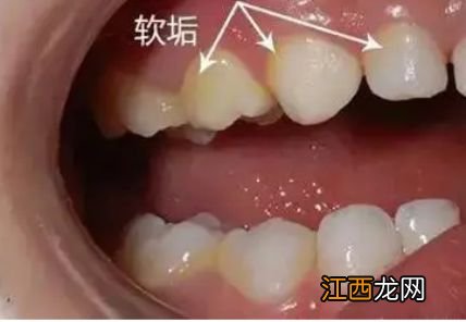 警惕儿童牙齿护理危害，17个禁忌勿触犯！