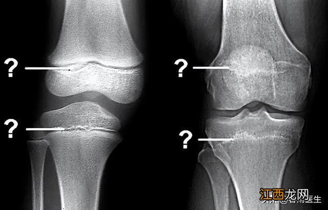 孩子身高“达标”了吗?看这四张图就懂了