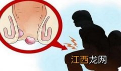 如何预防痔疮，介绍以下方法