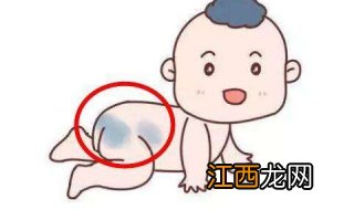 新生儿有胎记怎么办?5种最常见的胎记