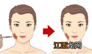 咬肌肥大怎么办？两种改善方法推荐