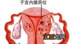 子宫内膜移位怎么办