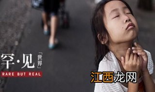 罕见病小孩如何面对生活,请助他一臂之力