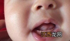 宝宝出牙的症状和规律图片 宝宝出牙的症状和规律