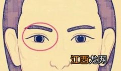 金鱼眼怎么办