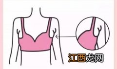 副乳怎么办