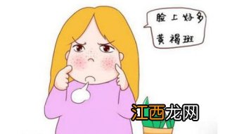 女人脸上长黄褐斑怎么办