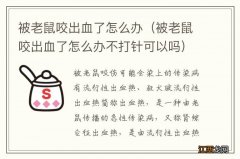 被老鼠咬出血了怎么办不打针可以吗 被老鼠咬出血了怎么办