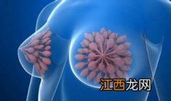 乳腺增生怎么办