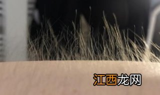 雄性激素分泌过多怎么办