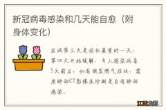 附身体变化 新冠病毒感染和几天能自愈