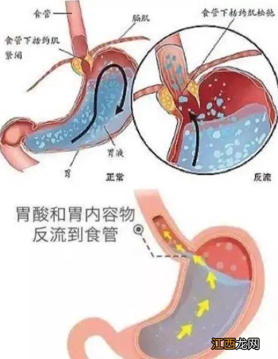 小手术不能吃什么东西怎么回事