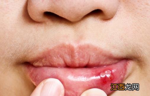 夏季炎热很容易上火 帮你清热泻火的日常食谱